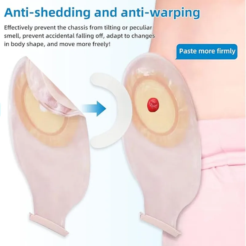 Medical Tape - Fita de Reforço para Bolsa de